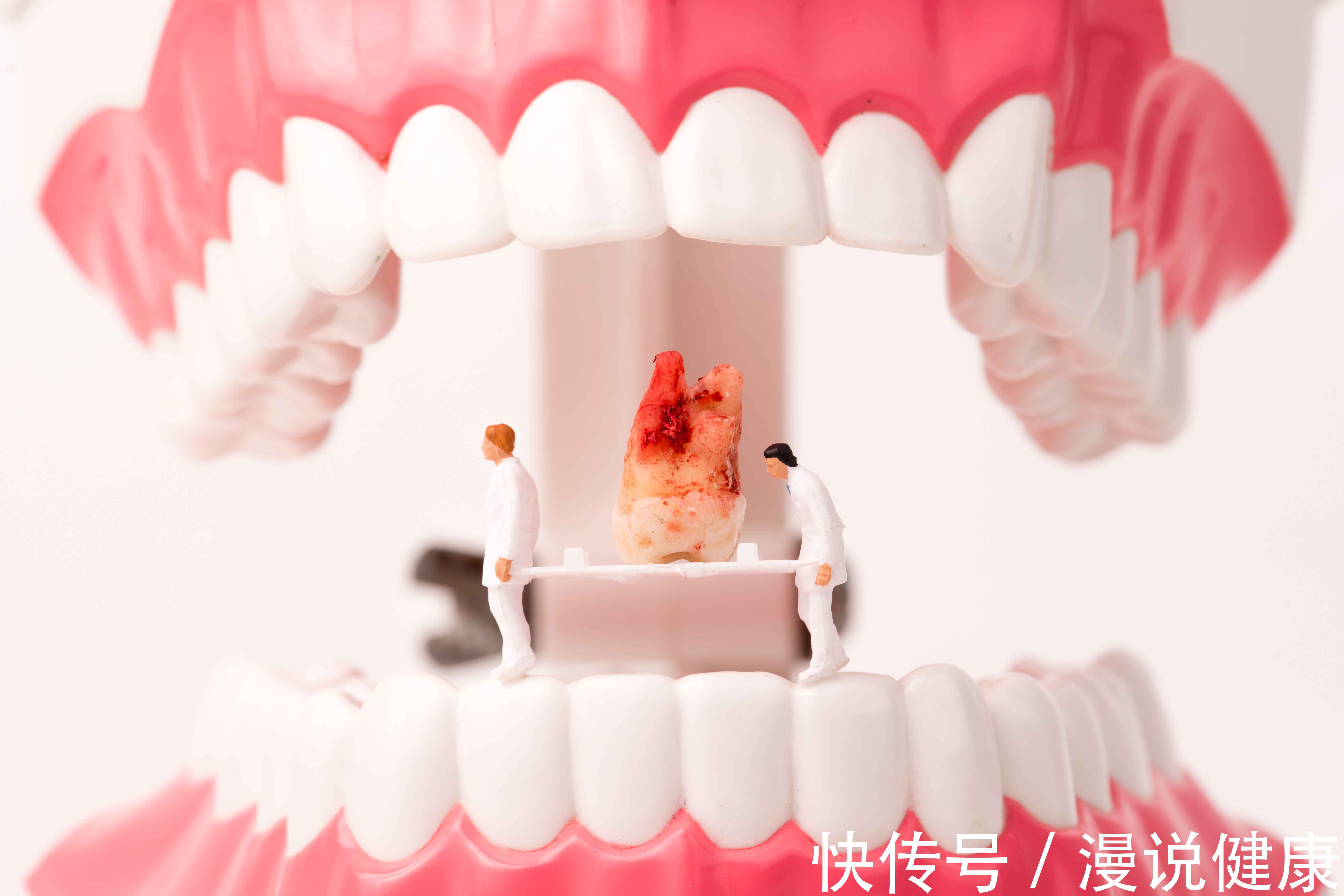 牙周病|35亿人有24亿人没去看牙医？牙龈出血，为何说是一个危险的信号？