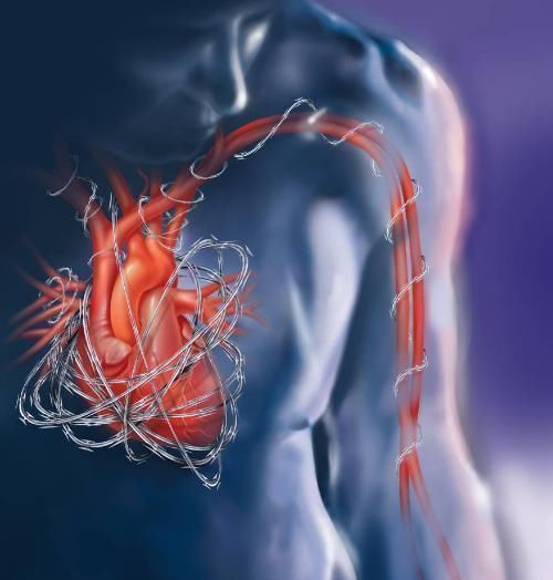 干净|血管“干净”的人，一般有三个“共性”，占上一个，也恭喜你了