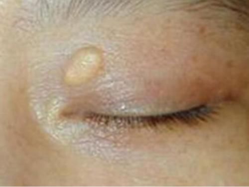 松花蛋|“高胆固醇”食物榜单公布,鸡蛋排最后,榜首很多人当成宝