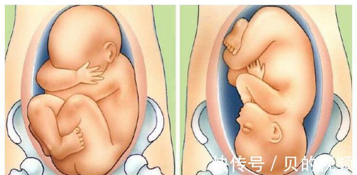 孕妇|到了这个孕周,胎儿“胎位”基本固定,以后再纠正就难了