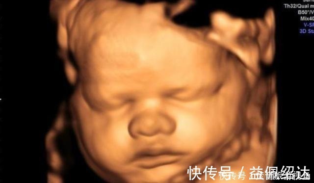 检查|“天才”胎儿走红,还在妈妈肚里就会“算数”,医生清华北大等你