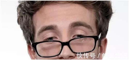 黑眼仁|上睑下垂眼无神,做个双眼皮手术就能搞定吗?