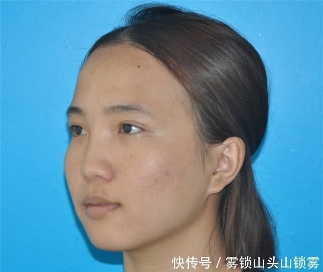 皮肤|爱化妆与喜欢素颜的女生，5年后皮肤有啥不一样网友差辈了吧