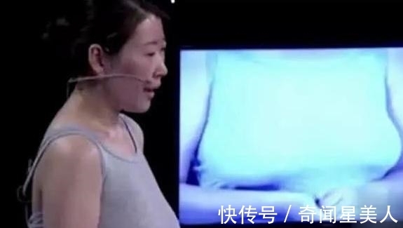 胸围|一女子38G胸围，嫌大想动手术变小，身在福中不知福