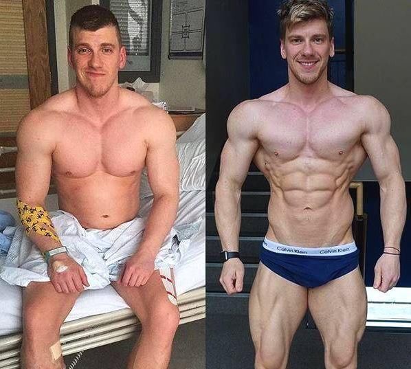 大重量|26岁健美冠军,小腿突发意外,体脂太低是“原罪”