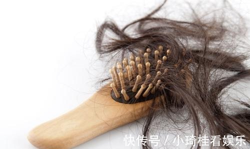 秘密|关于头发的小秘密你知道多少?脱发和正常掉发的区别在哪里呢?