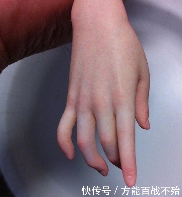 硅胶|硅胶手办似乎不错?听说摸起来感觉像真人,但保存是个大问题