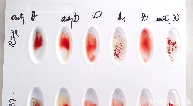 如果夫妻有O型血型,另一方有以下血型,孩子可能会赢在起跑线上