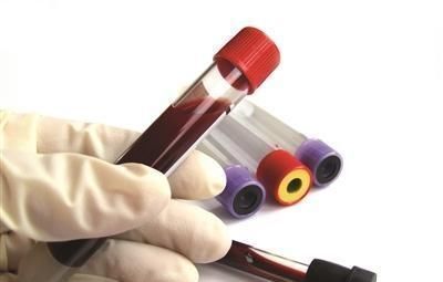 为啥甘油三酯降不下来清淡饮食是没错,少了以下3种食物就错了