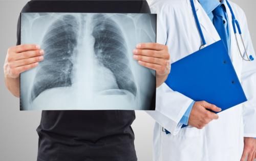 癌变率|多发肺结节癌变率有多高？医生提醒：一定要注意这3点