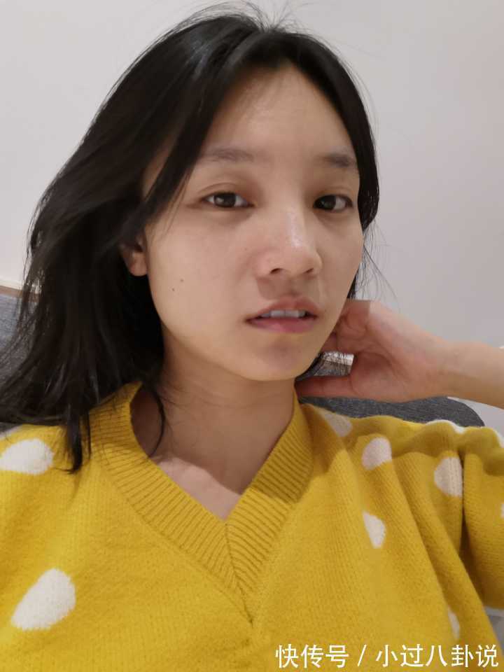 消化道出血|脸上出现这3种破绽，是肝不好？3个异常，或是肝脏病变