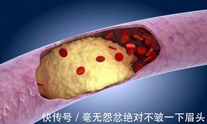 食物|患有糖尿病之后,以下7种食物不要吃,不然容易造成血糖上升