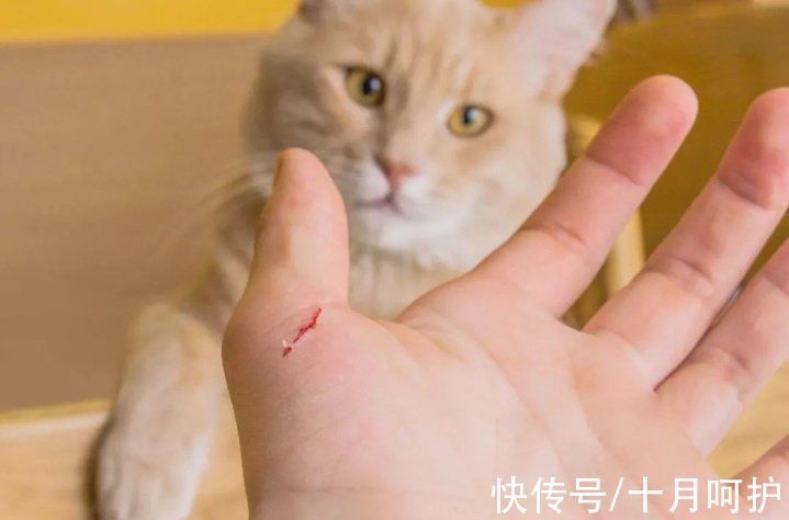 残疾|三岁女童被活活截断手指,终生残疾!只因用错创可贴,快自查