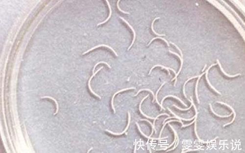 几率|孕妈妈不能养猫,会感染弓形虫?感染的几率有多大?