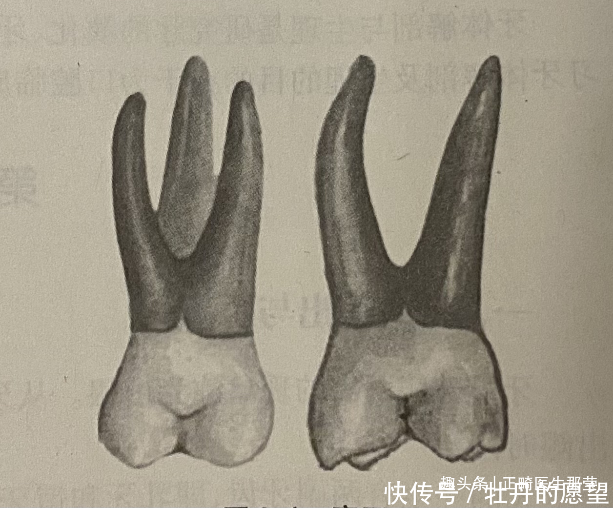  各司其职的牙齿