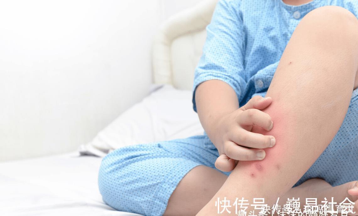 宝宝们|嗡嗡嗡，你听你听，蚊子在狰狞的笑，它最喜欢小宝宝