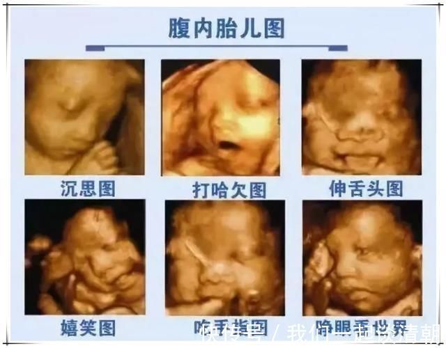 面部|胎宝在做四维时“好害羞”，折腾人还“白花钱”，怎样才会露脸？