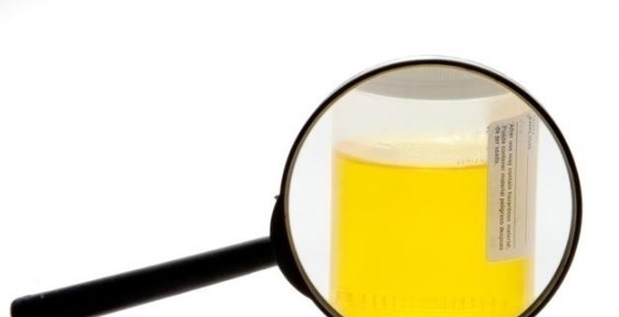 肝炎|开水里放几片,肝炎的“天敌”,每天喝一点,逼出多年肝毒