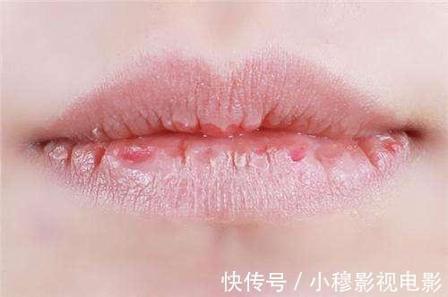 解毒|肝脏毒素增多了?嘴唇会有3个现象,若你1个都无,恭喜肝脏很干净