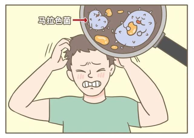 人为什么要有头屑啊