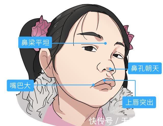 x型腿|原来喝骨头汤不补钙？教你正确的4个补钙方法，附6种高钙蔬菜