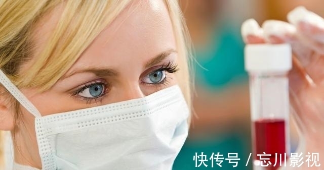 ph值|预防高尿酸的“四多”和“四少”分别指什么?