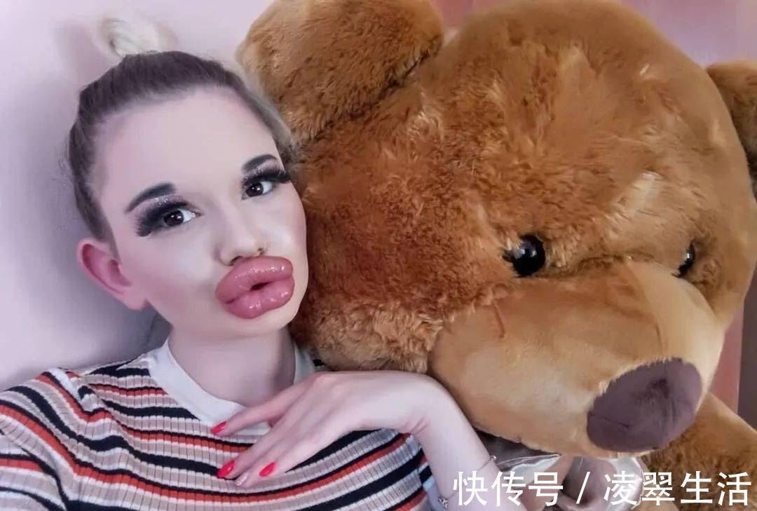 sofia 21次丰唇手术之后，这个妹子的嘴唇现在长这样…