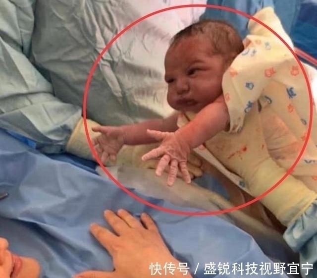 子宫|“最心急宝宝”走红,刚出娘胎就急着向妈妈求抱抱,网友太暖心