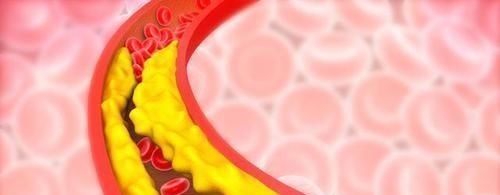 食物|血脂一降,百病消!日常多吃这6种食物,轻轻松松降血脂