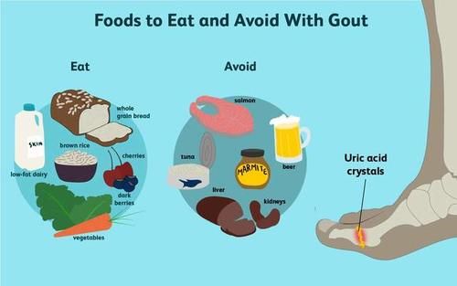 得了痛风，就啥也不能吃了？不！医生教您三大原则，享用美食不是梦
