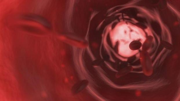 心脑血管疾病|每天吃大蒜的人到底能得到什么呢?也许看完之后,你就知道了!