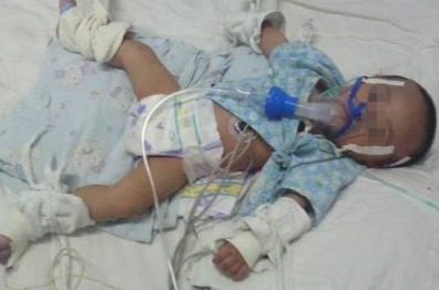 孩子|奶奶抱孙子去公园蹭奶,一星期后,亲手把孩子送进太平间