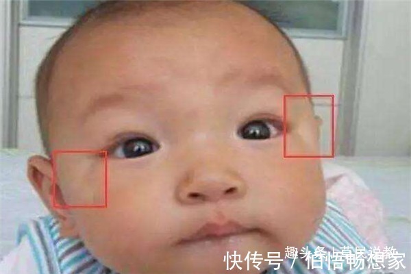 蛔虫|当孩子有这些情况时,便意示着肚子里有蛔虫了,父母们要留意了