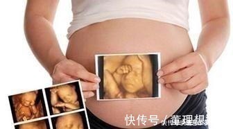 b超|孕期做四维有什么好处,什么时候做最好这个时候做是最好的