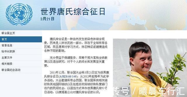 nt|世界唐氏综合征日:三类孕妇易怀“唐氏儿”,两项产检筛查很关键