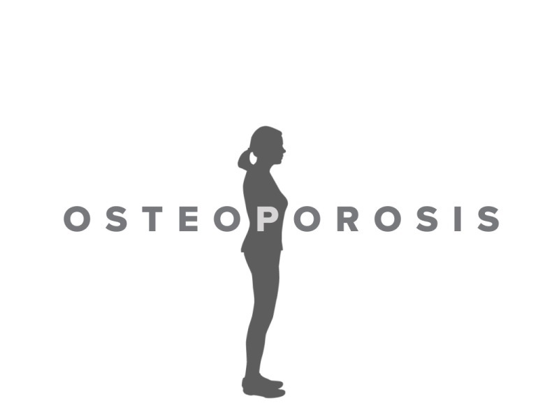 骨质疏松|50岁的女性开始进入更年期，面对这道坎儿，如何更好地治愈自己呢