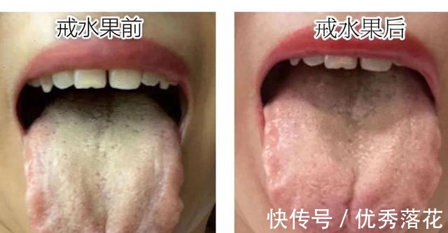 气虚|气血不足的人好累，三步回血摆脱「丧」感！