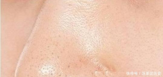 挤出|女生鼻子上能挤出“毛毛虫”?教你3个小妙招,远离“草莓鼻”!