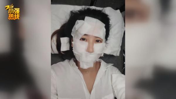 余杭区|23岁女子做医美，脸上发生奇怪变化，更不可思议的是…