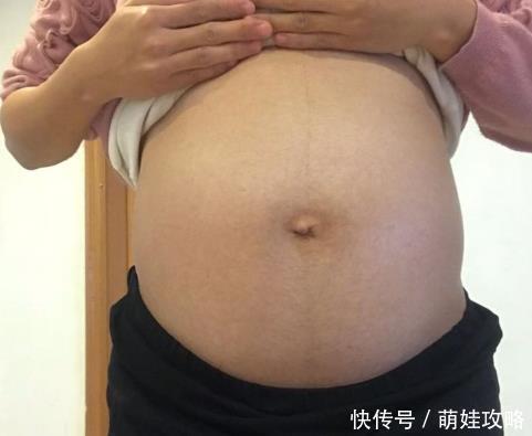 妈妈们|脐带绕颈一周，可能有这些影响，准妈妈要多留心眼