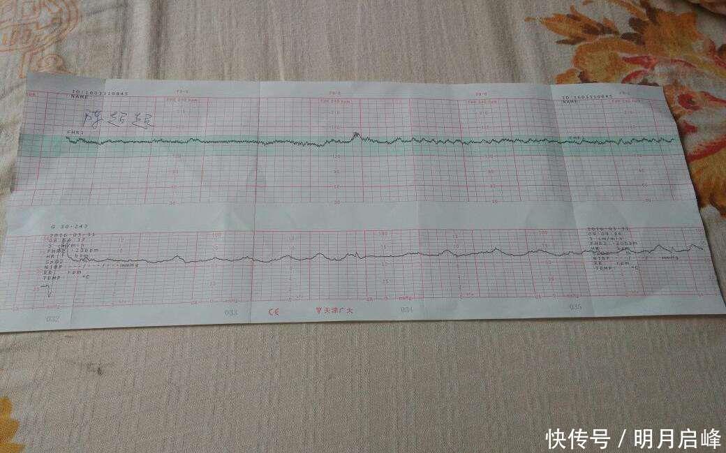 性别|怀“小王子”的宝妈,身上有这4大特征,赶快接好孕吧