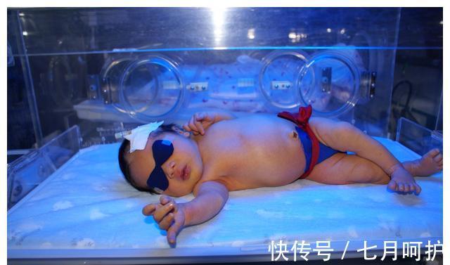 黄疸|孕期最好少吃这三种食物,它们是新生儿黄疸的温床,对孕妇也不利