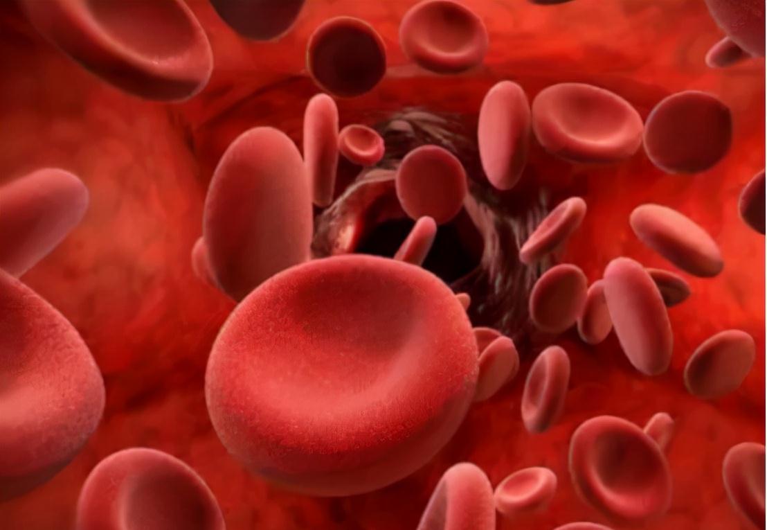 高血压|高血压患者:3种新型降压药,降压效果好,副作用更小