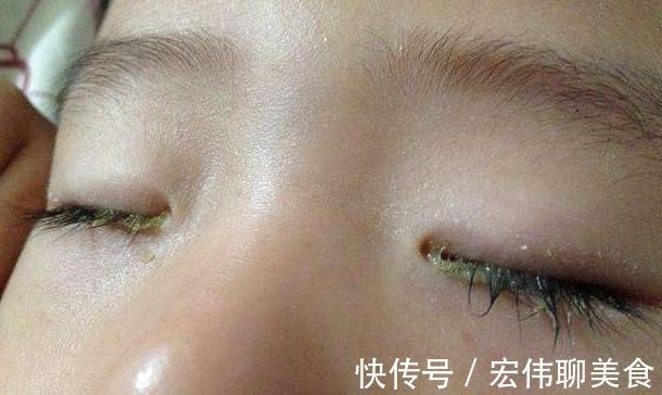 肝脏|肝火旺不旺,五官不会撒谎!照照镜子,若没有4个征兆,值得恭喜