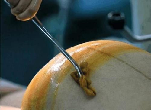 小动作|我就是不哭!”剖腹产宝宝“眼神杀”太霸气,网友:是个狠人