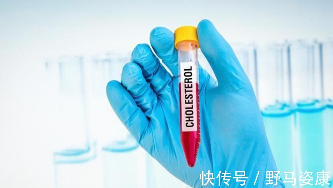 血脂|低密度脂蛋白越低越好吗？如何控制血脂指标，医生为你详解