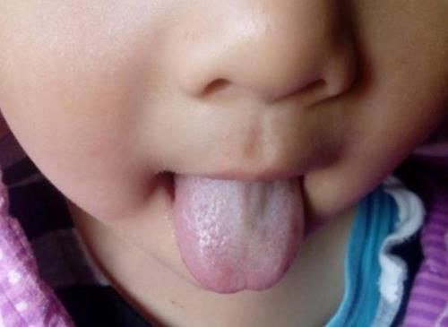 脾胃|儿科医生提醒:孩子积食不长个,少吃3种水果,养护脾胃消积食