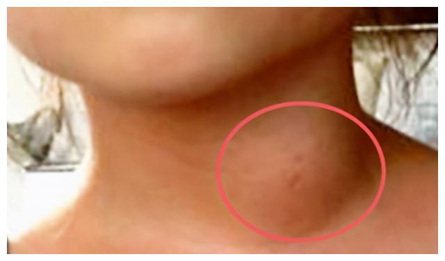 五姐妹|一家五姐妹全部得癌症，还是晚期，医生惋惜有些钱不能省