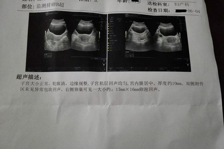 去医院做|孕期做B超，次数太多会“致畸”？虽不建议多做，但这五次不能漏