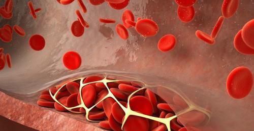 高血脂|“溶栓高手”公布,并非苦瓜,平时敞开吃,血管干净,远离头晕手麻